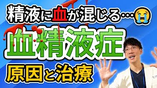 血精液症 の 原因・検査・治療 | 精液に血が混じっていたら？