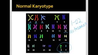 Intro to Karyotypes