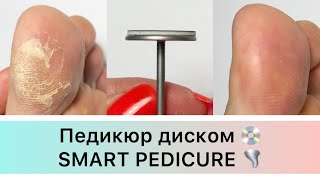 Педикюр диском 🦶💿 Smart pedicure 🌪 аппаратный педикюр