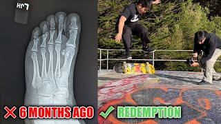 SKATE PROGRESSION AFTER BREAKING MY FOOT