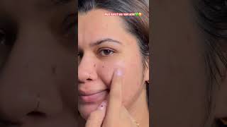 Two products for Acne/Breakouts 😲 #viral #shorts #shortvideo