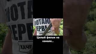 Открытый перелом на руке