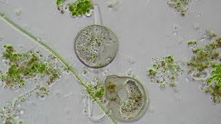 Pseudopodia of Testate Amoeba