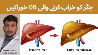 These 06 foods cause fatty liver | جگر کو خراب کرنے والی چھ خوراکیں