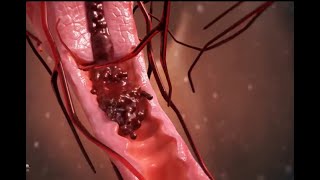 The menstrual cycle | Ovulation and menstruel cycle | 3D animation.