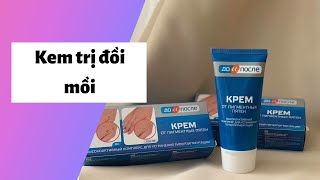 Review 7 kem trị đồi mồi Tốt, Hiệu quả, An toàn nhất | Kèm Giá Bán