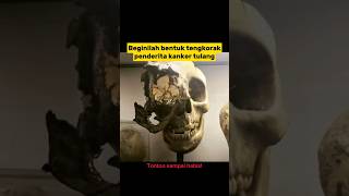 VIDEO YANG HARUS KALIAN LIHAT SEKALI SEUMUR HIDUP‼️ PART4