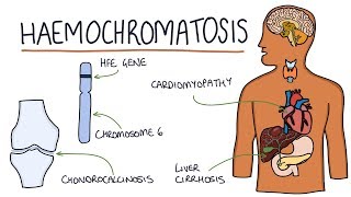 Understanding Haemochromatosis