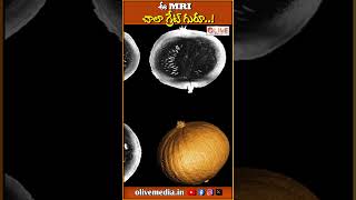 ఈ MRI చాలా గ్రేట్ గురూ..! | #mriscan #brainscan #equipment #trending #olivemedia