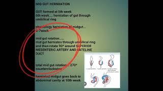 mid gut herniation| embryology lectures|fcps part-1 preparation forum