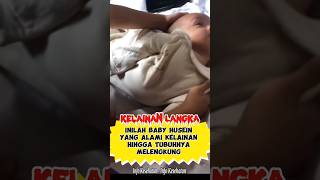 Bayi Bertubuh Melengkung #bayiarshaka #health #faktaunik #information #shorts #viral