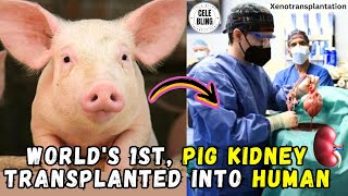 World's 1st Pig Kidney Transplanted into Human #xenotransplantation #pigkidney #science #CELEBLING