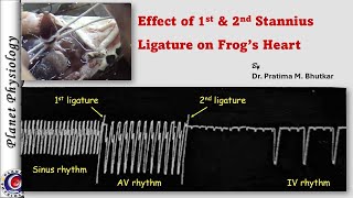 Effect of 1st & 2nd Stannius ligature on frog's heart