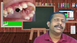 അടിസ്ഥാന ശാസ്ത്രം ക്ലാസ് 7 അന്നപഥത്തിലൂടെ 4 Through the alimentary canal 4