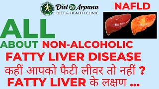 All About Non-Alcoholic Fatty Liver Disease (NAFLD) | Symptoms, Diagnosis and Prevention #nafld