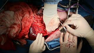 live stream ex lap in a dog with an abdominal mass