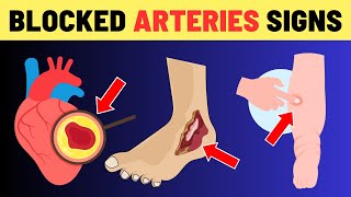 7 Warning Signs of Blocked Heart Arteries In Legs and Feet (Don't Ignore These Signals) | VisitJoy