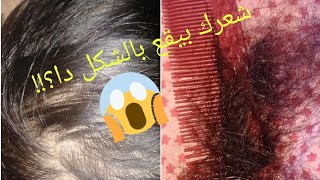 اقوي تركيبة #زيوت_طبيعيه لشعر قوي وكثيف خلال 7 ايام فقط(عن تجربه )