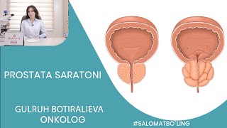 ПРОСТАТА САРАТОНИ/PROSTATA SARATONI- SHIFOKOR ONKOLOG GULRUH BOTIRALIEVA