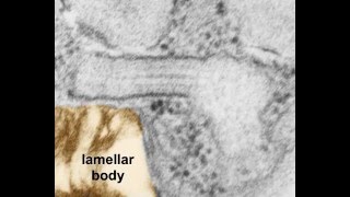 protein in the RER cisternal of an alveolar type II cell