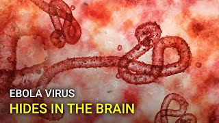 Ebola virus can hide in the brain