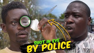 He Was Shot Straight In The Eye By Police