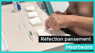 Réfection du pansement par le patient - Heartware