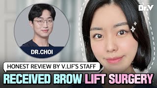 [Korea Plastic Surgery Review] Brow Lift Review By V.LIF'S Staff | V.LIF Plastic Surgery Clinic（中文）