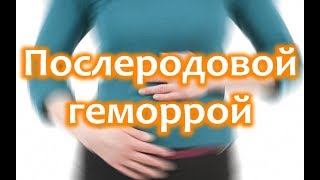 Послеродовой геморрой: чем и как лечить