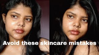 SkinCare Mistakes to Avoid as a Teen || Skincare Tips || Preetzle