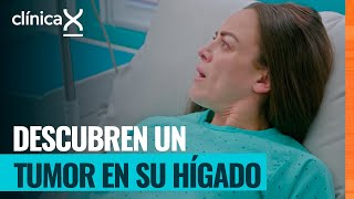 El consumo de esteroides pone en riesgo su vida | Clínica X