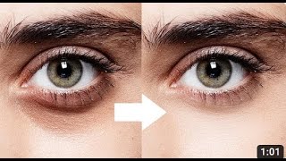 Remove Dark Circles Naturally in Photoshop Tutorial | Fastest Way Removing dark circles in Photoshop