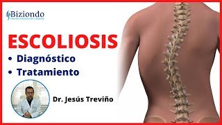 👨🏽‍⚕️ ¿Qué es la Escoliosis? |  Columna desviada ▶  Diagnóstico y tratamiento | BIZIONDO