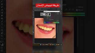 ازاي تحول الاسنان من اصفر الي ابيض #ابوموسى_فوتوشوب