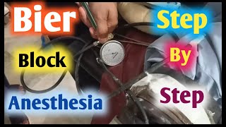 bier block anesthesia