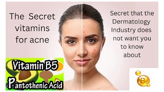 You dont need a 10 step skincare routine-All things you know about healing acne are a lies