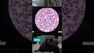 Digital Microscope #shortvideo #viralvideo #viralvideos #ytshorts #yt #digitalmicroscope #trending