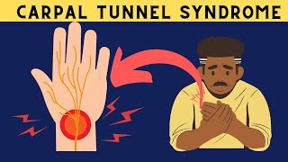 Carpal Tunnel Syndrome (CTS) -Risk Factors, Signs And Symptoms, Diagnosis And Treatment