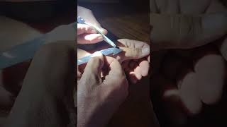 How to remove stitches. Taking out my stitches.....