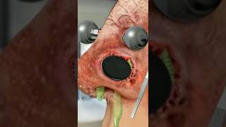 ASMR Removal Nose Piercing & Maggot infected Nose Animation #shortvideo #ytshorts