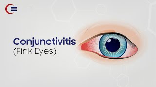 Conjunctivitis (Pink Eyes)