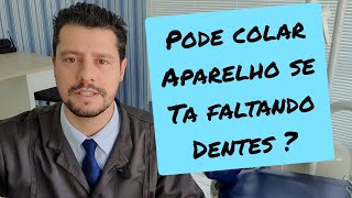 Pode colocar aparelho se ta faltando dente?