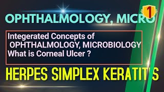 CORNEAL ULCER, HERPES SIMPLEX KERATITIS,  OPHTHALMOLOGY LECTURES, MICROBOLOGY LECTURE, NEETPG,INICET