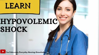 HYPOVOLEMIC SHOCK I DAY 55 I Everyday Nursing Knowledge