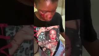 Lusaka based Boyfriend brutally beats up girlfriend for attending Rema's concert [WATCH VIDEO]