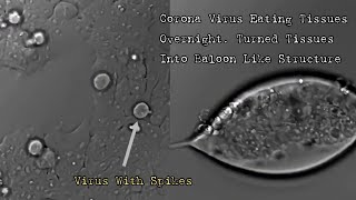 Covid-19: What the Virus Does to Tissues If You Get It. Overnight Replication #Covid19 #CoronaVirus