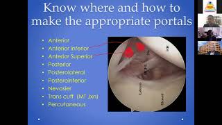 10 Tips for Successful Arthroscopic Bankart