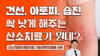 낫지 않는 건선, 아토피, 습진에 도움되는 산소치료, 체온치료, 기능의학치료(피부질환)