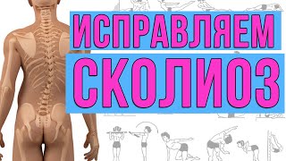 Исправляем сколиоз за 10 минут в день 18+