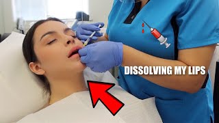 I got my LIP FILLER DISSOLVED!